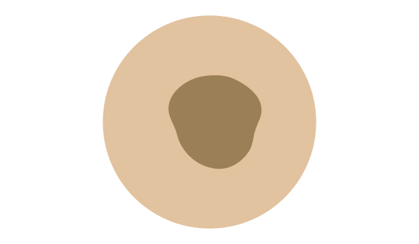 Changing and growing mole