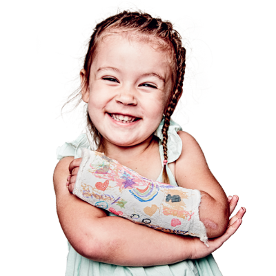 Young girl in arm cast smiling